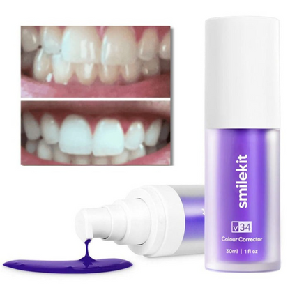 Blanqueador Dental Profissional V34 - PerfectSmile™